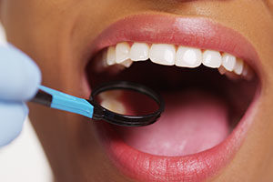 Dental care tools